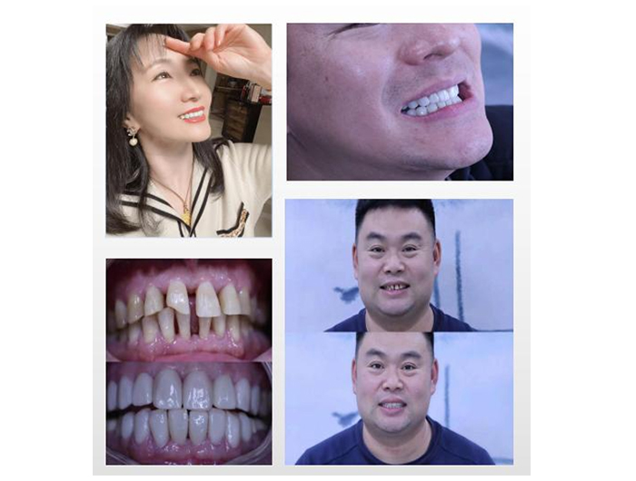 案例一